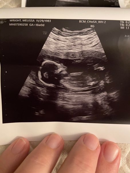 Melissa Wright Ultrasound